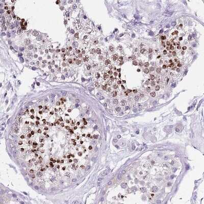 Immunohistochemistry-Paraffin: SPESP1 Antibody [NBP2-13370] - Staining of human testis shows strong cytoplasmic positivity in spermatids/ acrosomal cap.