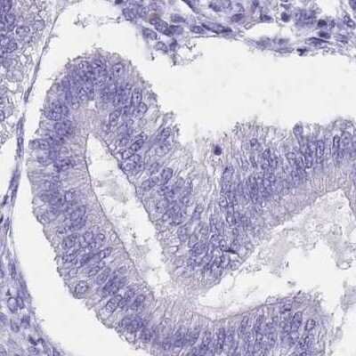 Immunohistochemistry-Paraffin: SPESP1 Antibody [NBP2-13370] - Staining of human endometrium.