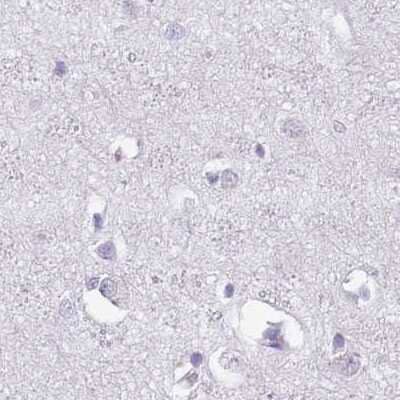 Immunohistochemistry-Paraffin: SPESP1 Antibody [NBP2-13370] - Staining of human cerebral cortex.