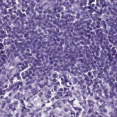 Immunohistochemistry-Paraffin: SPESP1 Antibody [NBP2-13370] - Staining of human lymph node.