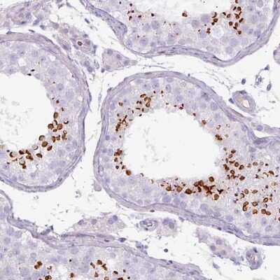 Immunohistochemistry-Paraffin: SPESP1 Antibody [NBP2-48994] - Staining of human testis shows high expression.