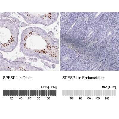 <b>Orthogonal Strategies Validation. </b>Immunohistochemistry-Paraffin: SPESP1 Antibody [NBP2-48994] - Staining in human testis and endometrium tissues using anti-SPESP1 antibody. Corresponding SPESP1 RNA-seq data are presented for the same tissues.