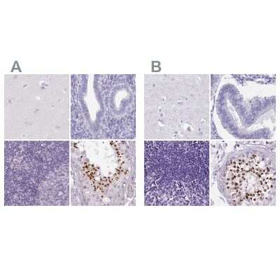 <b>Independent Antibodies Validation. </b>Immunohistochemistry-Paraffin: SPESP1 Antibody [NBP2-48994] - Staining of human cerebral cortex, endometrium, lymph node and testis using Anti-SPESP1 antibody NBP2-48994 (A) shows similar protein distribution across tissues to independent antibody NBP2-13370 (B).