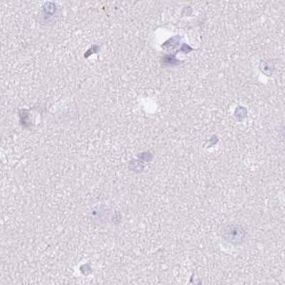 Immunohistochemistry-Paraffin: SPESP1 Antibody [NBP2-48994] - Staining of human cerebral cortex.