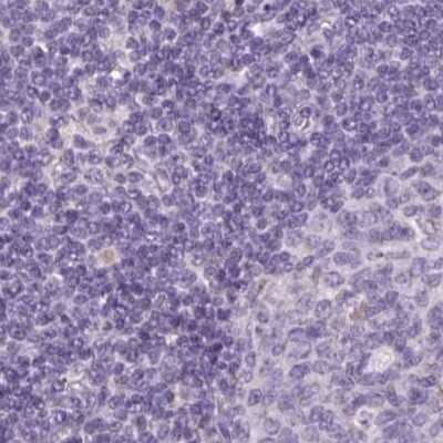 <b>Independent Antibodies Validation. </b>Immunohistochemistry-Paraffin: SPESP1 Antibody [NBP2-48994] - Staining of human lymph node.