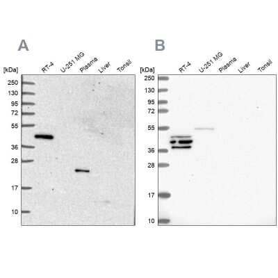 Western Blot: SPESP1 Antibody [NBP2-13370] - Analysis using Anti-SPESP1 antibody NBP2-13370 (A) shows similar pattern to independent antibody NBP2-48994 (B).