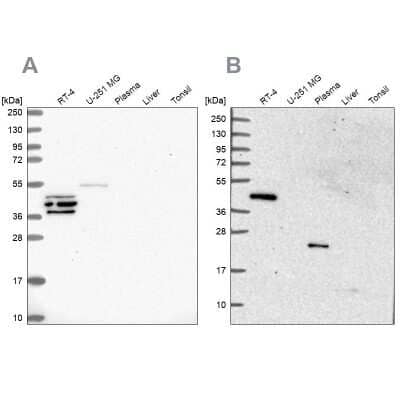 Western Blot: SPESP1 Antibody [NBP2-48994] - Analysis using Anti-SPESP1 antibody NBP2-48994 (A) shows similar pattern to independent antibody NBP2-13370 (B).