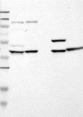 Western Blot: SPFH2 Antibody [21320002] - Samples:  Lane 1, Marker [kDa]: 250, 130, 95, 72, 55, 36, 28, 17, 11  Lane 2, RT-4  Lane 3, U-251MG sp  Lane 4, Human Plasma  Lane 5, Liver  Lane 6, Tonsil, Target weight [kDa]:   38, 17 (splice variants)  Validation score:  2   Validation description:  Supportive - Band of predicted size in kDa (+/-20%) with additional bands present.