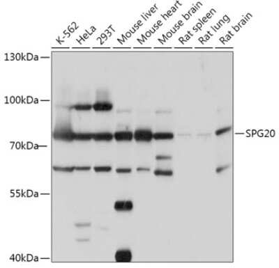 Western Blot: SPG20 Antibody [NBP2-94318] - Analysis of extracts of various cell lines, using SPG20 at 1:1000 dilution. Secondary antibody: HRP Goat Anti-Rabbit IgG (H+L) at 1:10000 dilution. Lysates/proteins: 25ug per lane. Blocking buffer: 3% nonfat dry milk in TBST. Detection: ECL Basic Kit . Exposure time: 30s.