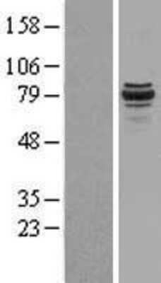 Western Blot: SPG20 Overexpression Lysate (Adult Normal) [NBL1-16394] Left-Empty vector transfected control cell lysate (HEK293 cell lysate); Right -Over-expression Lysate for SPG20.