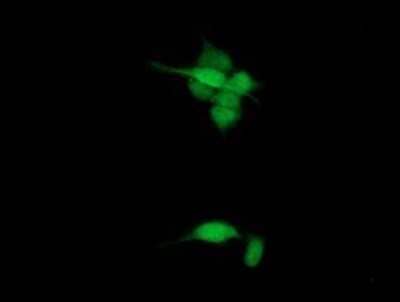 Immunocytochemistry/Immunofluorescence: SPG7 Antibody (OTI1C1) - Azide and BSA Free [NBP2-74327] - Staining of HeLa cells using anti-SPG7 mouse monoclonal antibody.