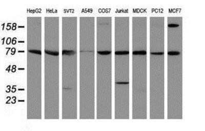 Western Blot: SPG7 Antibody (OTI1C1) - Azide and BSA Free [NBP2-74327] - Analysis of extracts (35ug) from 9 different cell lines by using anti-SPG7 monoclonal antibody.