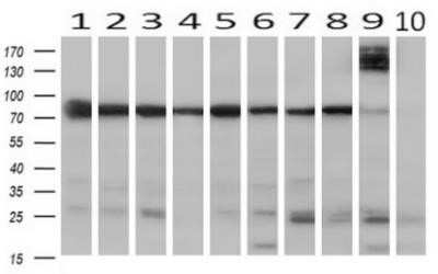 Western Blot: SPG7 Antibody (OTI1C1) - Azide and BSA Free [NBP2-74327] - Human tissue.