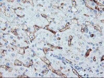 Immunohistochemistry: SPG7 Antibody (OTI1G4) - Azide and BSA Free [NBP2-74323] - Analysis of Human liver tissue. (Heat-induced epitope retrieval by 10mM citric buffer, pH6.0, 120C for 3min)