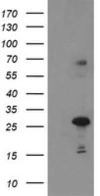 Western Blot: SPG7 Antibody (OTI1G4) - Azide and BSA Free [NBP2-74323] - Negative control E. coli lysate (Left lane) or E. coli lysate containing recombinant protein fragment for human SPG7(NP_003110) gene (amino acids 300-573) (Right lane). Equivalent amounts (5 ug per lane) were separated by SDS-PAGE and then immunoblotted w