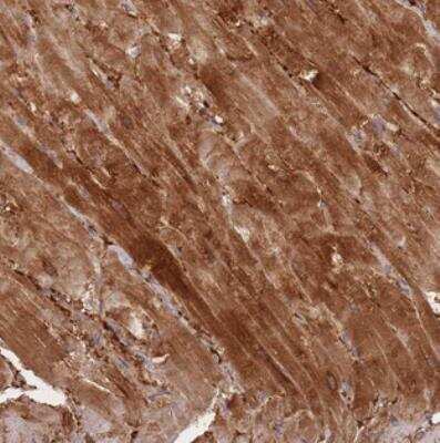 Immunohistochemistry: SPHKAP Antibody [NBP2-30973] - Staining of human heart muscle shows strong cytoplasmic positivity in myocytes.