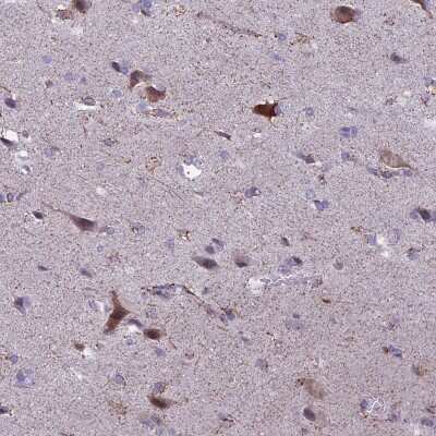 Immunohistochemistry-Paraffin: SPHKAP Antibody [NBP2-30770] - Staining of human cerebral cortex shows high expression.