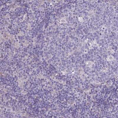 <b>Orthogonal Strategies Validation. </b>Immunohistochemistry-Paraffin: SPHKAP Antibody [NBP2-30770] - Staining of human tonsil shows low expression as expected.