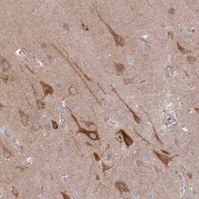 Immunohistochemistry-Paraffin: SPHKAP Antibody [NBP2-30973] - Staining of human cerebral cortex shows high expression.