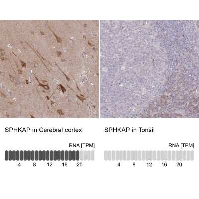 Immunohistochemistry-Paraffin: SPHKAP Antibody [NBP2-30973] - Staining in human cerebral cortex and tonsil tissues using anti-SPHKAP antibody. Corresponding SPHKAP RNA-seq data are presented for the same tissues.