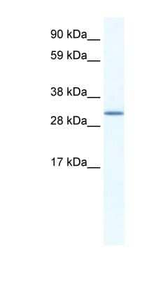 Western Blot: SPIC Antibody [NBP1-80288] - SP2/0 cell lysate, concentration 1.25ug/ml.