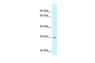Western Blot: SPIC Antibody [NBP2-84277] - WB Suggested Anti-SPIC Antibody. Titration: 1.0 ug/ml. Positive Control: ACHN Whole Cell