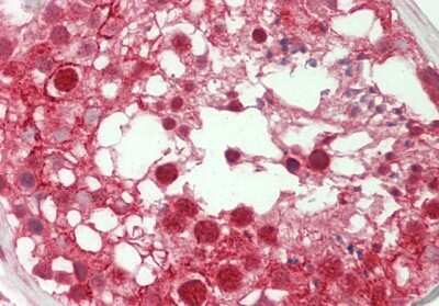 Immunohistochemistry-Paraffin: SPIN1 Antibody [NBP2-83590] - Rabbit Anti-SPIN1 antibody. Formalin Fixed Paraffin Embedded Tissue: Human Testis. Primary antibody Concentration: 1:100. Secondary Antibody: Donkey anti-Rabbit-Cy3. Secondary Antibody Concentration: 1:200. Magnification: 20x. Exposure Time: 0.5-2.0sec