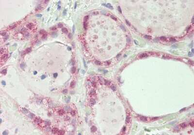 Immunohistochemistry-Paraffin: SPIN1 Antibody [NBP2-83590] - Rabbit Anti-SPIN1 antibody. Formalin Fixed Paraffin Embedded Tissue: Human Thyroid. Primary antibody Concentration: 1:100. Secondary Antibody: Donkey anti-Rabbit-Cy3. Secondary Antibody Concentration: 1:200. Magnification: 20x. Exposure Time: 0.5-2.0sec