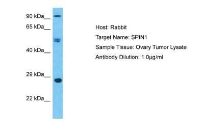 Western Blot: SPIN1 Antibody [NBP2-83589] - Host: Rabbit. Target Name: SPIN1. Sample Type: Ovary Tumor lysates. Antibody Dilution: 1ug/ml