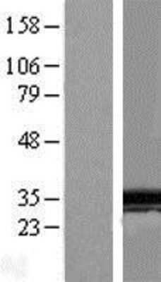 Western Blot: SPIN1 Overexpression Lysate (Adult Normal) [NBL1-16401] Left-Empty vector transfected control cell lysate (HEK293 cell lysate); Right -Over-expression Lysate for SPIN1.