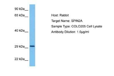 Western Blot: SPIN2A Antibody [NBP2-83592] - Host: Rabbit. Target Name: SPIN2A. Sample Tissue: Human COLO205 Whole Cell lysates. Antibody Dilution: 1ug/ml