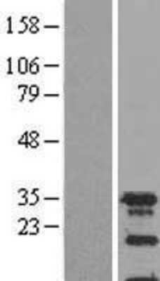 Western Blot SPIN2A Overexpression Lysate