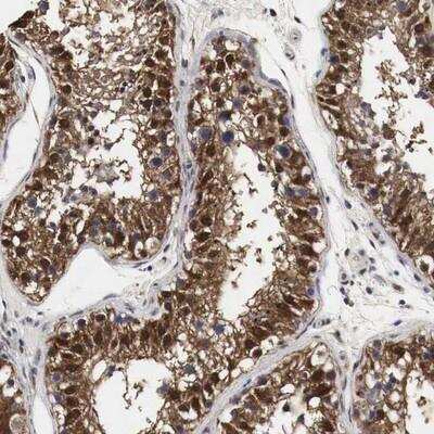Immunohistochemistry-Paraffin SPIN2B Antibody - BSA Free