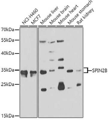 Western Blot SPIN2B Antibody - BSA Free