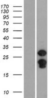Western Blot: SPIN2B Overexpression Lysate (Adult Normal) [NBP2-08831] Left-Empty vector transfected control cell lysate (HEK293 cell lysate); Right -Over-expression Lysate for SPIN2B.
