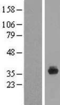 Western Blot SPIN4 Overexpression Lysate