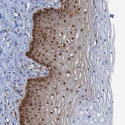Immunohistochemistry-Paraffin: SPINDOC Antibody [NBP1-81298] - Staining of human cervix, uterine shows strong nuclear positivity in squamous epithelial cells.