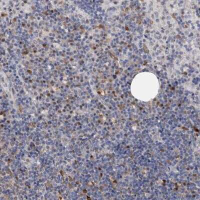 Immunohistochemistry-Paraffin: SPINDOC Antibody [NBP1-81298] - Staining of human lymph node shows moderate nuclear positivity in germinal and non-germinal center cells.