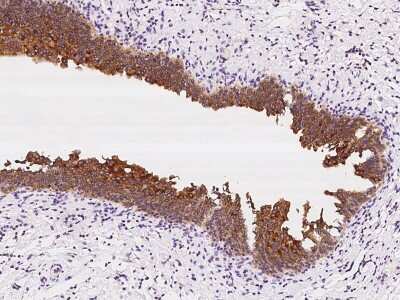 Immunohistochemistry-Paraffin: SPINK1 Antibody [NBP2-98602] - Immunochemical staining of human SPINK1 in human gallbladder with rabbit polyclonal antibody at 1:100 dilution, formalin-fixed paraffin embedded sections.