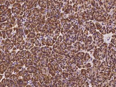 Immunohistochemistry-Paraffin: SPINK1 Antibody [NBP2-98602] - Immunochemical staining of human SPINK1 in human pancreas with rabbit polyclonal antibody at 1:100 dilution, formalin-fixed paraffin embedded sections.