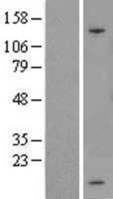 Western Blot: SPINK1 Overexpression Lysate (Adult Normal) [NBL1-16405] Left-Empty vector transfected control cell lysate (HEK293 cell lysate); Right -Over-expression Lysate for SPINK1.