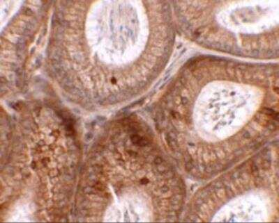 Immunohistochemistry: SPINK2 Antibody [NBP2-82015] - Immunohistochemistry of SPINK2 in mouse testis tissue with SPINK2 antibody at 2.5 ug/mL.