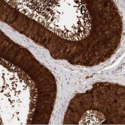 Immunohistochemistry-Paraffin: SPINK2 Antibody [NBP1-83133] - Staining of human epididymis shows strong cytoplasmic positivity in glandular cells.