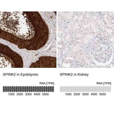 Immunohistochemistry-Paraffin SPINK2 Antibody - BSA Free