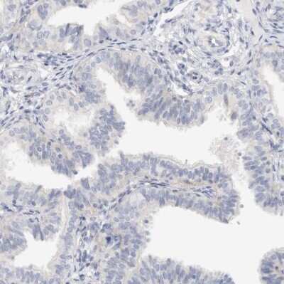 Immunohistochemistry-Paraffin: SPINK2 Antibody [NBP1-83133] - Staining of human fallopian tube shows no cytoplasmic positivity in glandular cells as expected.