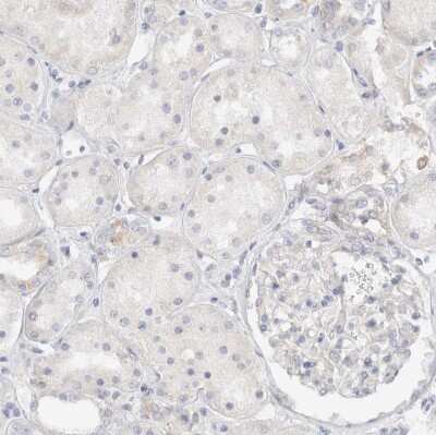 Immunohistochemistry-Paraffin: SPINK2 Antibody [NBP1-83133] - Staining of human kidney shows no cytoplasmic positivity in cells in tubules as expected.