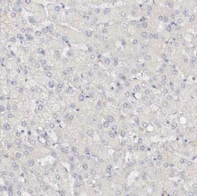 <b>Orthogonal Strategies Validation. </b>Immunohistochemistry-Paraffin: SPINK2 Antibody [NBP1-83133] - Staining of human liver shows no cytoplasmic positivity in hepatocytes as expected.