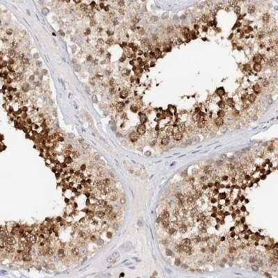 Immunohistochemistry-Paraffin: SPINK2 Antibody [NBP1-83133] - Staining of human testis shows strong cytoplasmic positivity in cells in seminiferous ducts.