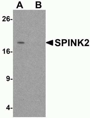 Western Blot SPINK2 Antibody - BSA Free
