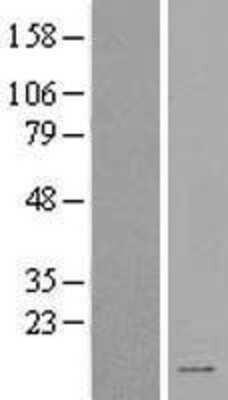 Western Blot SPINK2 Overexpression Lysate